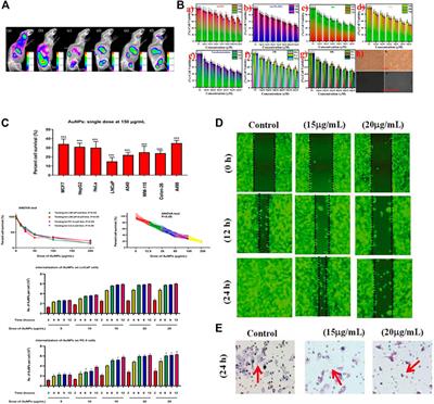 Current applications of nanomaterials in urinary system tumors